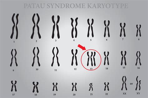 cromossomos 13